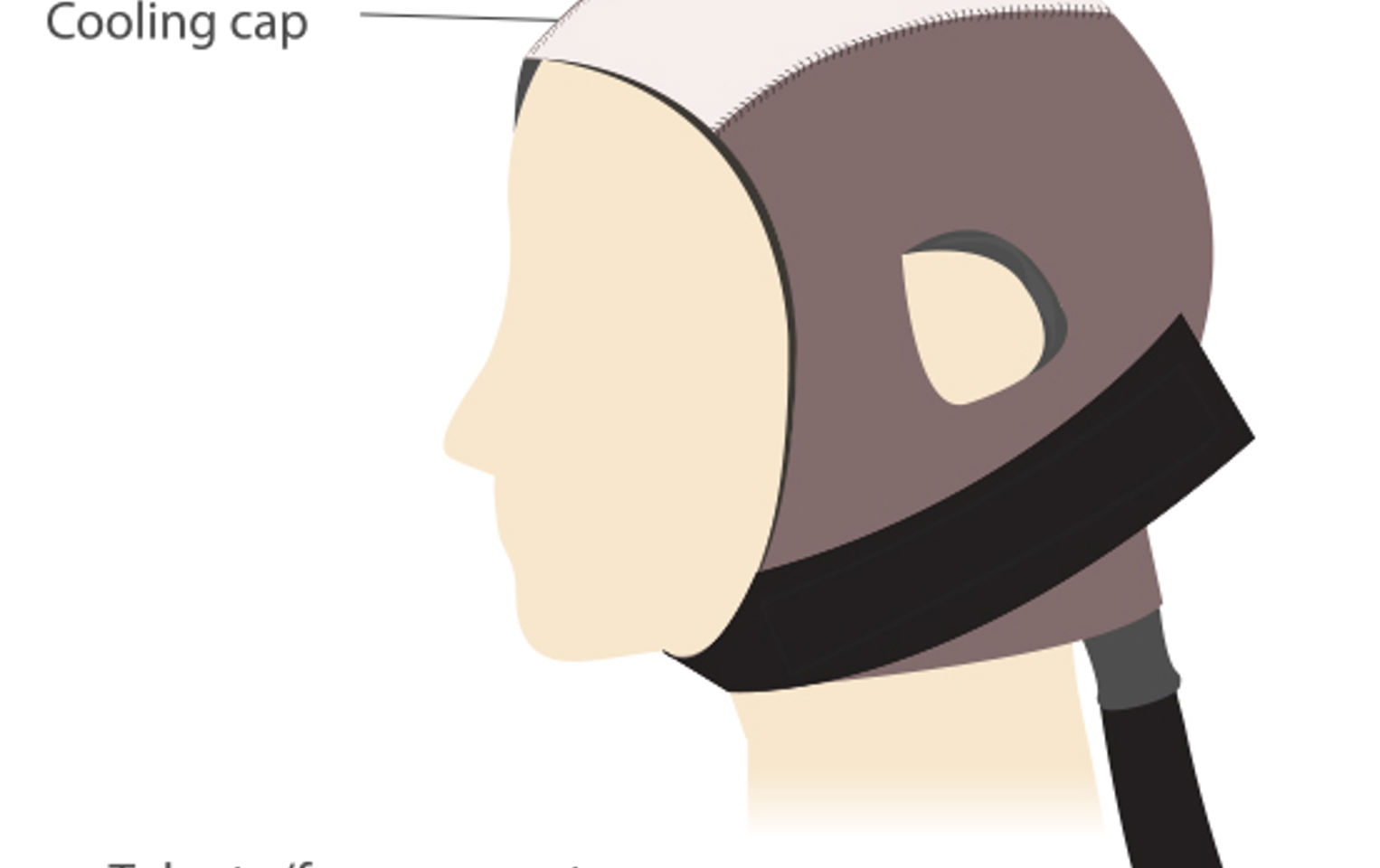 Image of a scalp cooling cap